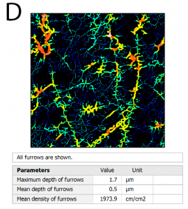 furrow analysis tooth wear performes on surface