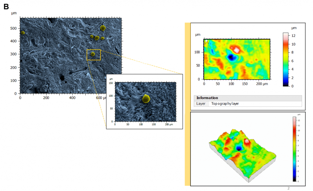 Using 3D reconstruction of SEM images to reverse-engineer the human ...